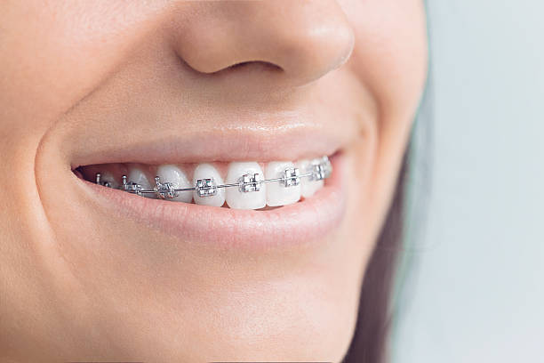 Laser Dentistry in Brooktrails, CA